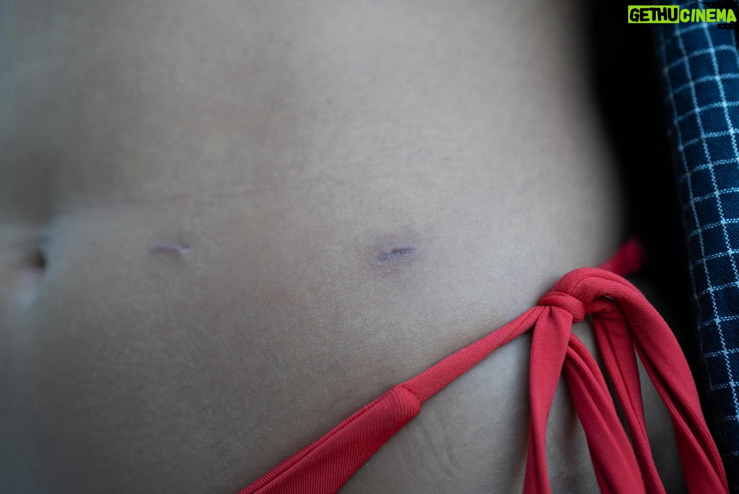 Aisha Dee - 57.2K Likes - To my sweet darling Endometriosis, you are one conniving little bitch. We’ve experienced so much together! A whole decade of chronic pain, medical gaslighting, nausea, cramps that felt like barbed wire and fire shooting throughout my entire body, the resulting feelings of isolation and paranoia… hectic stuff. And though I have loved this “lesson” in patience and endurance, I am so so grateful to see the ass-end of you. I promise to use my privilege to spread awareness and act as a resource and support for my fellow endo babies. I promise to never take my body for granted. I promise to go outside and throw my ass around in a circle this summer. Thank you body! Thank you thank you thank you, amen xo