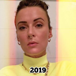 Jennifer Weist Instagram - 2015-2025

CN: Auf Foto 3 trage ich Cornrows, auf Foto 5 trage ich Braids, das sind geflochtene Frisuren, die in den verschiedensten Kulturen eine tiefere kulturelle und historische Bedeutung haben. Weshalb ich für das Tragen dieser Braids - zu Recht - kritisiert wurde. Durch die Kritik habe ich mich dann das erste Mal mit dem Thema kulturelle Aneignung auseinandergesetzt. «Cultural Appropriation» bezeichnet den unreflektierten oder respektlosen Prozess, bei dem die Mitglieder einer dominanten Kultur Elemente aus einer anderen, oft marginalisierten oder unterdrückten Kultur übernehmen, ohne deren Bedeutung oder Kontext zu verstehen oder zu respektieren. Dieser Vorgang ist besonders problematisch, wenn die kulturellen Elemente ohne Zustimmung, Anerkennung oder ein Bewusstsein für die historischen und sozialen Zusammenhänge verwendet werden. Kulturelle Aneignung kann dazu führen, dass Traditionen komplett verfälscht werden oder sogar verloren gehen. Und wenn Religion oder Tradition dann noch zu Produkten werden, die durch Trends kommerzialisiert und von Menschen aus privilegierten Gruppen billig und unethisch produziert und verkauft werden, leidet das Einkommen der Menschen, die die originalen Produkte herstellen und verkaufen. Heute weiß ich, dass Braids nicht einfach nur eine geflochtene Frisur sind, sondern in vielen Kulturen weltweit Tradition, Identität und Gemeinschaft repräsentieren. Ich weiß, dass kulturelle Aneignung immer in Verbindung mit Kolonialismus, Rassismus und ungleichen Machtverhältnissen steht. Ich, als weiße Frau, werde diese Art von Frisur in Zukunft deshalb nicht mehr tragen.