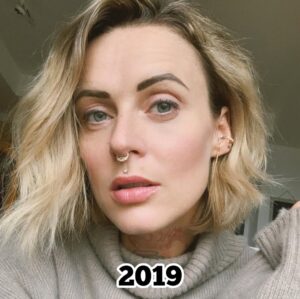 Jennifer Weist Instagram - 2015-2025

CN: Auf Foto 3 trage ich Cornrows, auf Foto 5 trage ich Braids, das sind geflochtene Frisuren, die in den verschiedensten Kulturen eine tiefere kulturelle und historische Bedeutung haben. Weshalb ich für das Tragen dieser Braids - zu Recht - kritisiert wurde. Durch die Kritik habe ich mich dann das erste Mal mit dem Thema kulturelle Aneignung auseinandergesetzt. «Cultural Appropriation» bezeichnet den unreflektierten oder respektlosen Prozess, bei dem die Mitglieder einer dominanten Kultur Elemente aus einer anderen, oft marginalisierten oder unterdrückten Kultur übernehmen, ohne deren Bedeutung oder Kontext zu verstehen oder zu respektieren. Dieser Vorgang ist besonders problematisch, wenn die kulturellen Elemente ohne Zustimmung, Anerkennung oder ein Bewusstsein für die historischen und sozialen Zusammenhänge verwendet werden. Kulturelle Aneignung kann dazu führen, dass Traditionen komplett verfälscht werden oder sogar verloren gehen. Und wenn Religion oder Tradition dann noch zu Produkten werden, die durch Trends kommerzialisiert und von Menschen aus privilegierten Gruppen billig und unethisch produziert und verkauft werden, leidet das Einkommen der Menschen, die die originalen Produkte herstellen und verkaufen. Heute weiß ich, dass Braids nicht einfach nur eine geflochtene Frisur sind, sondern in vielen Kulturen weltweit Tradition, Identität und Gemeinschaft repräsentieren. Ich weiß, dass kulturelle Aneignung immer in Verbindung mit Kolonialismus, Rassismus und ungleichen Machtverhältnissen steht. Ich, als weiße Frau, werde diese Art von Frisur in Zukunft deshalb nicht mehr tragen.