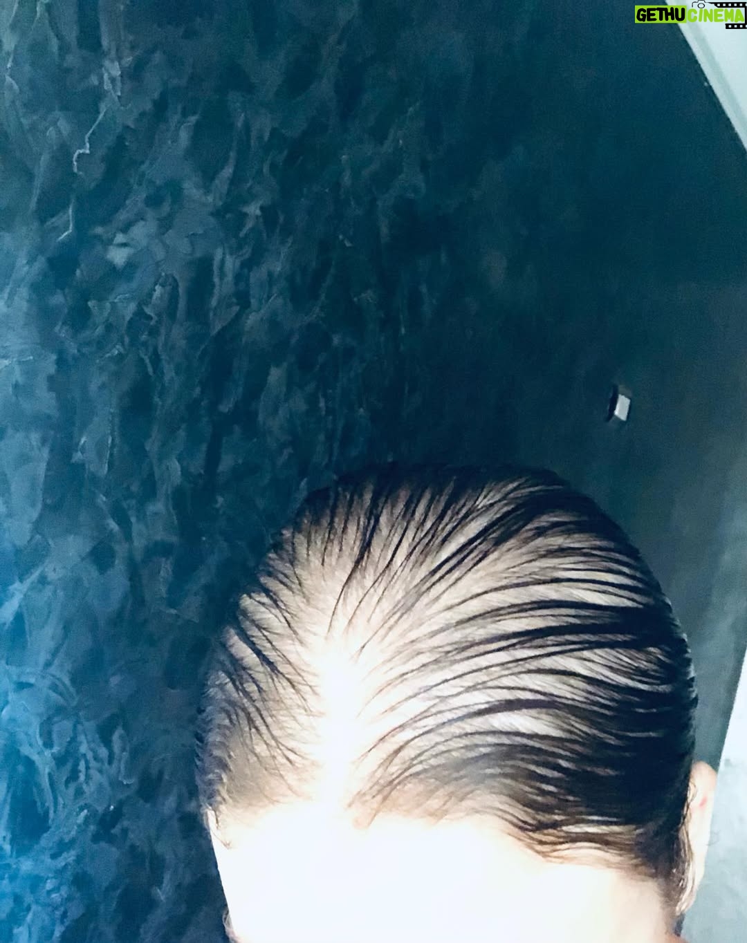 Rahma Hassan - 26.1K Likes - This is my hair this is what I’m dealing with everyday.. two years now… my health is okay elhamdollh, but my heart is broken I have stress all the time.. I even don’t want to do anything because of this….. you have no idea how tired I am…I never show… so I want to share. I’m not going to delete it now. Until I’m really okay.
شعري ابتدا يقع من الجذور و يقع اكتر بعد ما رحت عيادة زو Zo في الزمالك و المفروض انه افضل حاجة موجودة .. كشفت و عملت التحليل المطلوبة كلها .كان شعري عادي خفيف تعبان لكن مش بيقع بيقع كام شعرة عادي ! بعد ما روحت و عملت التحليل الدكتورة قالتلي كلها تمام ممكن بس الحديد نازل شويا ! ممكن ناخد حديد … و هنعمل بلازم من دمك يعني حاجة كويسة و امان ميه في المية! اوكي . طبعا .. المهم روحت و سالتني الدكتورة قبل البلازمة بعد سحب الدم ! اخبار الظغط بتاعك ايه ! قولت مش عارفة ! قالتلي طيب المهم عملت اللازمة و و ميزوثاربي!!!! مش بلازمة بس ! الكارثة انه حططلي حقنة مينوكسيديل مع الحقنة و عملتها بالميزوثاربي! و طبعا انا معرفتش غير لما روحت البيت لان كان ضربات قلبي غريبة و حسا اني تعبانة و دماغي ثقيلة … بشوف الفاتورة لقيته انها حططلي مينوكسيديل بدون ما ترجعلي الاول و انا كنت بس مفروض اعمل بلازمة فقط من دمي … بس .من ساعتها شعري بيقع كل يوم و مافيش بيبي هير بيطلع اصلا و لو طلع بيقع تاني علي طول …. لو اعرف من الاول مكنتش روحت ابدا ..لانهم حطولي حاجة اول مرة استعملها بدون مايرجعولي الاول .. و في حاجة مهمة زي دي كان عندي ثقة قبل ما اروح لكن طبعا بعد اللي حصل مروحتش تاني ابدا و شعري فضل يقع من ساعتها … اكتر و اكتر و كل الناس عارفة انك لو استعملت المينوكسيديل مينفعش يتوقف … و هما عملو الكارثة دي بدون ما يقولولي الاول حتي … و من ساعتها و انا شعري و نفسيتي في الارض .