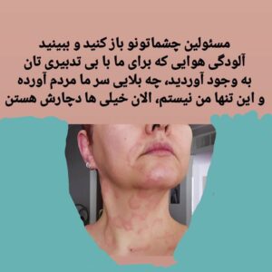 Anahita Hemmati Instagram - .
نتیجه بی تدبیری و بی اهمیت و بی ارزش بودن سلامت و جان افراد و زندگی مردم#ایران  برای  حکمرانان این کشور.....
#آلودگی_هوا #آلودگی_زیست_محیطی #آلودگی_محیط_زیست #آلرژی_شدید #آسم #تنگی_نفس #سرطان #ام_اس #اگزما #اگزمای_پوست #کهیر #کهیر_مزمن #کهیرپوستی #بیماریهای_خودایمنی #سرطان_ریه #آسم_شدید
#anahitahemmati #anahita 
#آناهیتا_همتی #آناهیتاهمتی #آناهیتا 
پی نوشت:صفحه های زردی که از این عکس ها سوء استفاده کنند همگی ریپورت و بلاک خواهند شد.