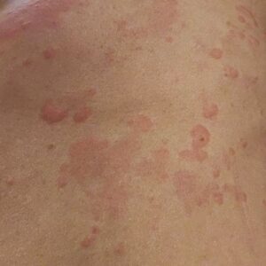 Anahita Hemmati Instagram - .
نتیجه بی تدبیری و بی اهمیت و بی ارزش بودن سلامت و جان افراد و زندگی مردم#ایران  برای  حکمرانان این کشور.....
#آلودگی_هوا #آلودگی_زیست_محیطی #آلودگی_محیط_زیست #آلرژی_شدید #آسم #تنگی_نفس #سرطان #ام_اس #اگزما #اگزمای_پوست #کهیر #کهیر_مزمن #کهیرپوستی #بیماریهای_خودایمنی #سرطان_ریه #آسم_شدید
#anahitahemmati #anahita 
#آناهیتا_همتی #آناهیتاهمتی #آناهیتا 
پی نوشت:صفحه های زردی که از این عکس ها سوء استفاده کنند همگی ریپورت و بلاک خواهند شد.