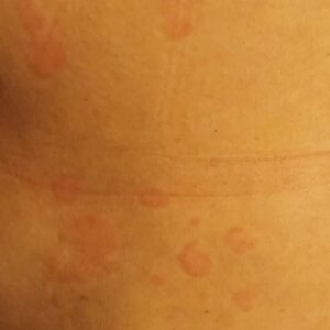 Anahita Hemmati Instagram - .
نتیجه بی تدبیری و بی اهمیت و بی ارزش بودن سلامت و جان افراد و زندگی مردم#ایران  برای  حکمرانان این کشور.....
#آلودگی_هوا #آلودگی_زیست_محیطی #آلودگی_محیط_زیست #آلرژی_شدید #آسم #تنگی_نفس #سرطان #ام_اس #اگزما #اگزمای_پوست #کهیر #کهیر_مزمن #کهیرپوستی #بیماریهای_خودایمنی #سرطان_ریه #آسم_شدید
#anahitahemmati #anahita 
#آناهیتا_همتی #آناهیتاهمتی #آناهیتا 
پی نوشت:صفحه های زردی که از این عکس ها سوء استفاده کنند همگی ریپورت و بلاک خواهند شد.