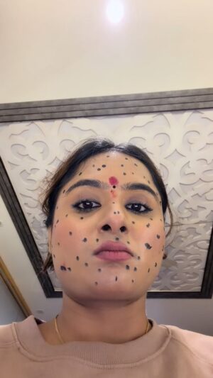 Diksha Choudhary Instagram - Wait for it🥹😭🤣😂
.
.
#Funnyvideos #pimplehack #comedy #relatable #girls