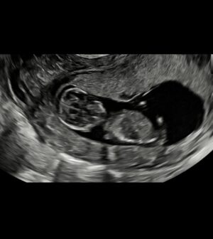 Lieke Martens Instagram - So happy to announce 👶🏻❤️