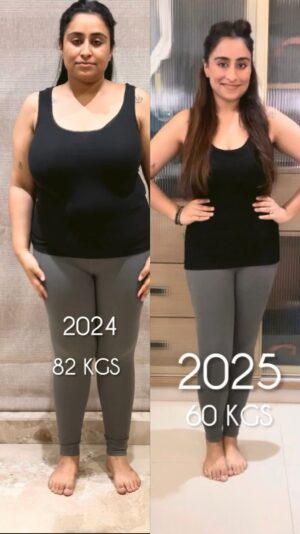 Noopur Kalra Instagram - 22 kgs down āØ
And since I know this question is coming again āHow did you lose the weight?ā hereās my honest answer.
Firstly, Iām NOT a professional or an expert.
This is just what worked for me. If youāre planning to lose weight, I highly recommend getting professional guidance instead of following random advice online.
Hereās what I followed very diligently šš½
⢠Protein became non negotiable
Protein was a game changer for me through food and protein supplements. It helped with satiety, energy, and consistency.
Please consult a nutritionist to understand what works for your body.
⢠I ate MORE, not less
I stopped starving myself.
Six small, balanced meals a day worked way better than crash dieting.
Trust me you need to eat to lose weight. I learnt this the hard way.
⢠No crash diets. Ever.
They donāt last. They donāt heal your relationship with food.
⢠Home food over Swiggy and Zomato
Even āhealthyā food outside is cooked with ingredients you canāt control.
When I was serious about my goals, I mostly ate home cooked meals.
⢠Hydration is underrated
Most cravings are actually dehydration.
Once I started drinking enough water, the urge for sweets and fried food reduced a LOT.
⢠No extreme restrictions
I didnāt completely cut off sweets or outside food.
I had them occasionally mindfully without guilt.
And the most important part šš½
I worked with my nutritionist @getfitwithsush
Sheās been a huge reason behind this transformation and has helped not just me, but so many others too. I was with her for almost 1.5 years, and because of that consistency, Iāve now learnt how to manage my lifestyle on my own.
Weight loss isnāt magic.
Itās discipline, patience, guidance and being kind to yourself.
If youāre on a similar journey, Iām rooting for you š¤
And please remember what worked for me may not work for everyone.
#WeightLossJourney #noopurkalra