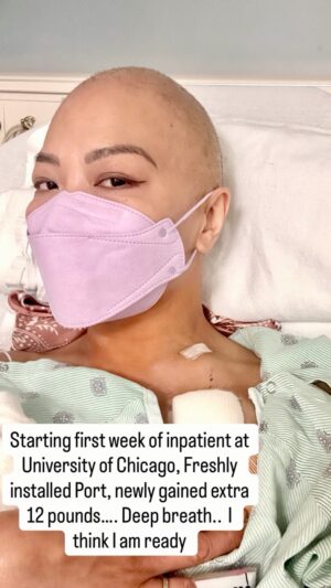 Shirley Chung Instagram - My Tongue Cancer Journey Part #3 

August 2024 was filled with hope, tears, scares and happiness.  I finished 9 weeks of Chemo at @cedarssinai, the tumor on my tongue shrunk, I was be able to speak more clearly and eat more solid food. 
💔We decided to close @mschicafe and focus on my treatments.
 👰‍♀️🤵‍♂️ My little sister got married in the forest and I was be able to complete my speech at her wedding as an elf fairy 🧝‍♀️
🏥 We moved to Chicago, officially started Radiation Treatments @uchicago ☢️
💜🖤 met my warrior sister @immaculateaether Aubryn in the radiation waiting room. 🦄Marked the beginning with the toughest most painful 10 weeks of my life 💪
#chefshirleychung #cancerwarrior #dumplingmafiaqueen #fuckcancer #tonguecancer #cancerjourney #unicorn #cancersurvivors
