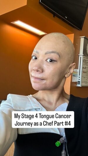 Shirley Chung Instagram - My stage 4 tongue cancer journey #4. This one was tough for me. At .37 seconds of this reel, the pictures might be triggering ❤️‍🩹 I experienced the most painful 3 weeks of my life. Radiation burned inside and outside of my mouth and neck, I lost the ability to speak & swallow. Had to use suction machine for blood and mucus buildup so I won’t choke. Started on Fentanyl patch with morphine every 2.5 hours (highest dosage a person can take), and pouring lidocaine down my throat. 3 weeks of time were a blur, I wanted to scream, but was in too much pain. I even had to skip a day of radiation because my mouth were too bloody had too many blisters for mouth guard. All I remember was starring at the clock through my teary eyes, counting minutes till my next dose of morphine🩸But ultimately I pulled through! Fought like a chef! Completed 10 weeks, 50 rounds of Radiation Chemo, rang the Victory Bell 🔔💪🦄 #chefshirleychung #cancerwarrior #dumplingmafiaqueen #fuckcancer #tonguecancer
