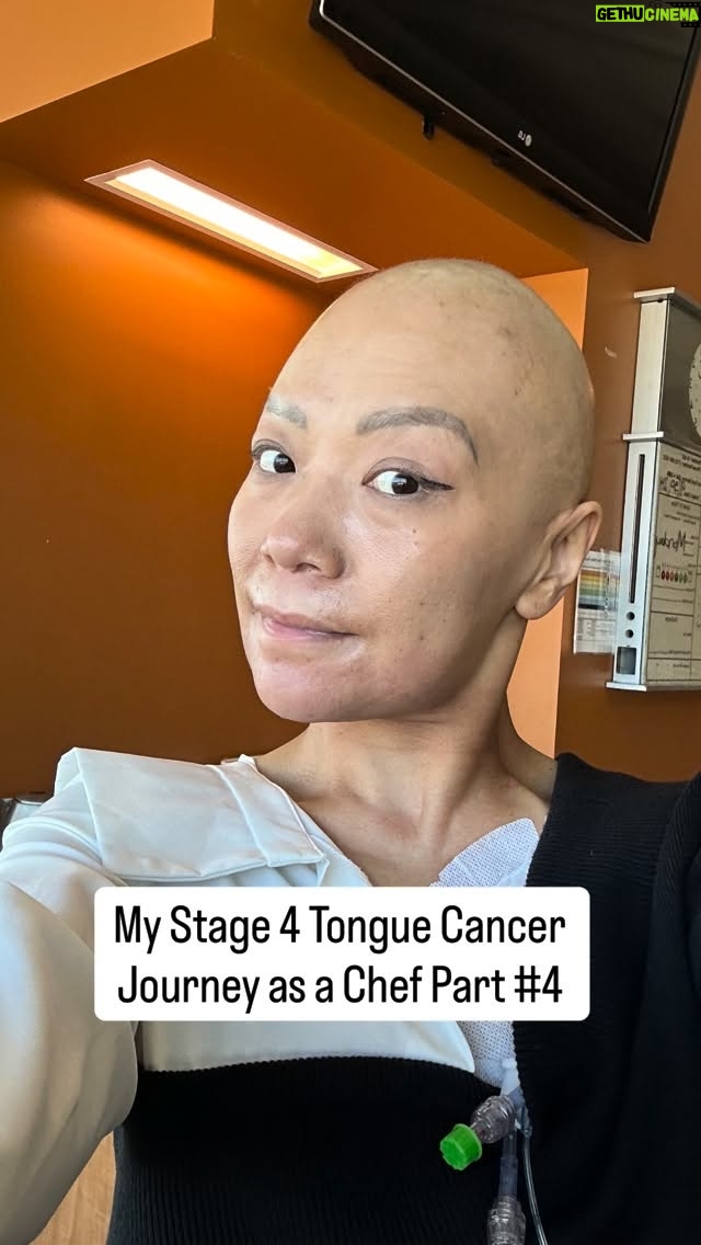 Shirley Chung - 21.7K Likes - My stage 4 tongue cancer journey #4. This one was tough for me. At .37 seconds of this reel, the pictures might be triggering ❤️‍🩹 I experienced the most painful 3 weeks of my life. Radiation burned inside and outside of my mouth and neck, I lost the ability to speak & swallow. Had to use suction machine for blood and mucus buildup so I won’t choke. Started on Fentanyl patch with morphine every 2.5 hours (highest dosage a person can take), and pouring lidocaine down my throat. 3 weeks of time were a blur, I wanted to scream, but was in too much pain. I even had to skip a day of radiation because my mouth were too bloody had too many blisters for mouth guard. All I remember was starring at the clock through my teary eyes, counting minutes till my next dose of morphine🩸But ultimately I pulled through! Fought like a chef! Completed 10 weeks, 50 rounds of Radiation Chemo, rang the Victory Bell 🔔💪🦄 #chefshirleychung #cancerwarrior #dumplingmafiaqueen #fuckcancer #tonguecancer