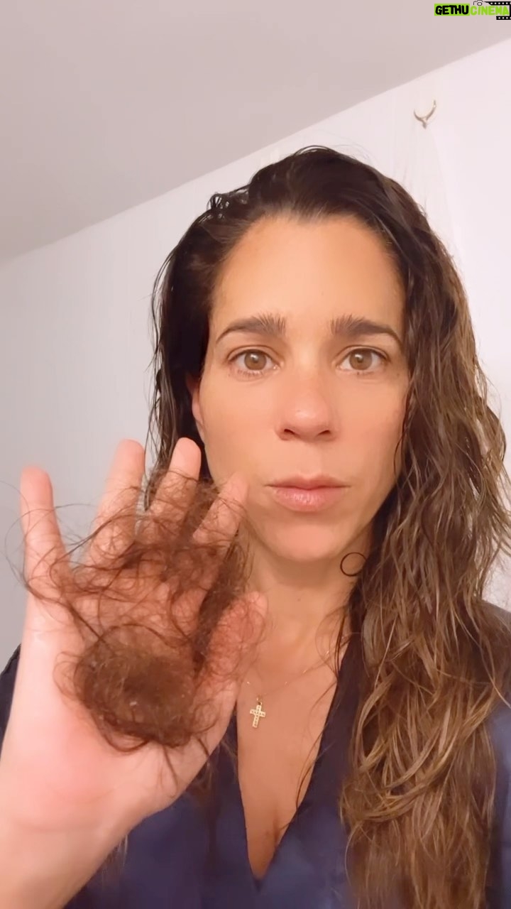 Vanessa Terkes - 9.9K Likes - Auxilio!!! A alguien más le pasa? Alguna recomendación! ☹️