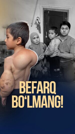 Ziyoda Instagram - Ushbu murojaat bemorning onasi Jumayeva Saboxat tomonidan o‘z roziligi bilan berilmoqda.
Mablag‘lar to‘g‘ridan-to‘g‘ri bemorning o‘ziga tegishli bank kartasiga yuboriladi.
Men ushbu holatda faqat axborot yetkazuvchi sifatida yordam bermoqdaman, pul mablag‘larini qabul qilmayman va boshqarmayman.
Yordam qilmoqchi bo‘lganlar uchun karta ma’lumotlari pastda keltirilgan.

9860 0827 4984 7487 Humo
  Xalq banki
5614 6828 1799 8463 Uzcard
  BRB bank
5614 6818 7528 9054 Uzcard 
  Hamkor Bank

Jumayeva Saboxat (bemorning onasi)
 Karta ulangan raqam 
 998947282387
