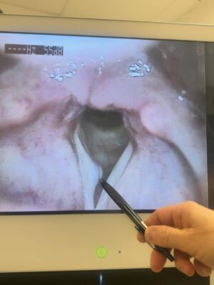 Carola Häggkvist Instagram - ’Det kunde inte gått bättre’ var Dr Johans första ord. -’Jag har ingenting jag skulle kunna önskat mer för operationen idag’ sa han. ♥️♥️🙌🏼 Å, vilka glädjande styrkande ord! Nu blir det å skriva sig fram, i lagom dos. Och vila, ( sova på Hans arm. ) Jag har blivit nedsövd idag under operationen, kände mig trygg & förtröstansfull innan då jag tittade in i dr Johans ögon, lite ont i huvudet nu, hals och käkparti.. men annars mår jag bra och får jag äta och dricka som vanligt. Nu vill jag dock mest dricka varmt då jag & väninnorna - Bente & Viveca kom hem till ett kallt trähus där elen  lagt ned. Just idag!! Ha ha typiskt. Antingen så e det det ena eller det andra.. men allt brukar lösa sig. Man får ha lite is i magen och tro på att allt blir till det bästa ändå. ( Min  granne i vita huset lite  längre bort lägger om sina rör och grävskopan hade lyckats kapa rören endast till mitt hus … ) Så på med mössan o moonbootsen igen.. och så ett besök hos mina närmaste grannar C&B som tar hand om mig just nu. TACK till alla som tog hand om mig så fint idag, hela gänget som var inne på operation : Max, Martin, Sara & dr Johan på Sophiahemmet och foniatriska avdelningen. 👏🏼👏🏼🙏🏼 Och tack till alla och då menar jag verkligen ALLA som så omsorgsfullt hört av sig till mig, hållit alla tummar och knäppt ihop båda händerna för mig och skrivet här. Tusen tack kära vänner! Love you. Puss 💋 och kram Glad C. #johanberséus #plainvanillaswe @plainvanillaswe @sophiahemmet @johanberseus