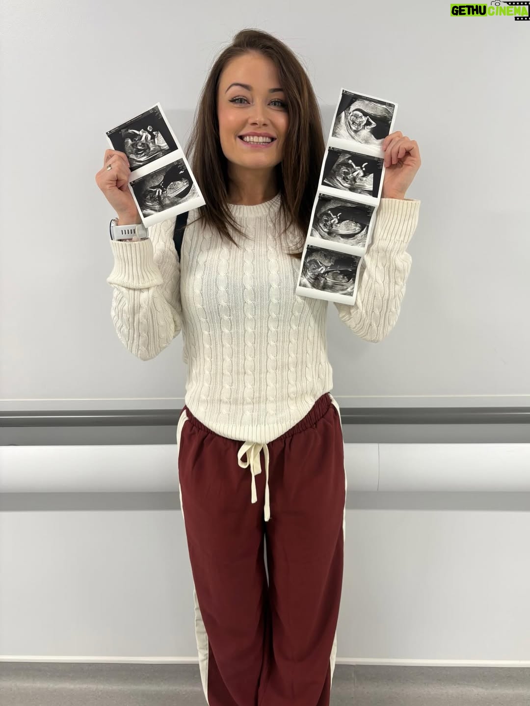 Jess Impiazzi - 18.8K Likes - It’s been hard keeping this secret, especially as a huge over sharer 😂🩵
It’s not been an easy journey but my @sambird_official has been there through every ivf appt, every jab, every hospital appt, and I love him so much. We’re so excited to welcome our little boy in May 2026 and cannot wait to meet him 🩵🩵

You can read about our journey and my fertility issues in this weeks @closeronline (magazine) and how lupus and fertility has been quite the challenge 🩵 #lupusfertility #lupus #ivf