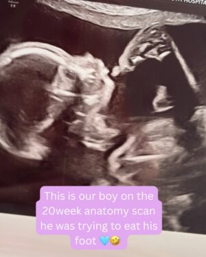 Jess Impiazzi Instagram - A little story time to introduce myself to any new people following my story with autoimmune disease, IVF and pregnancy 🤰🏻 
🩵

#ivf #pregnancy #23weekspregnant #lupus #lupuspregnancy