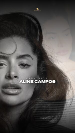 Aline Campos Instagram - Essa não é uma história sobre estética.
Essa é uma história sobre verdade, sobre reconstrução, sobre reencontro.

Para uma mulher que sempre foi estereotipada pela própria beleza e pelas suas convicções, provar que tudo é além da beleza, se torna um desafio até mais forte.

Aline não nos procurou para mudar quem ela era, mas, sim, para alinhar o rosto com a pessoa que ela se torna a cada dia.

Quer continuar acompanhando a história da @soualinecampos ? Aguarde.

✅Publicação de caráter acadêmico em conformidade com o despacho 143/2019 Conselho Federal de Medicina, art. 75, e autorizado via Termo de Consentimento Informado.
✅O resultado imediato pode sofrer alterações da cicatrização, inchaço, reabsorção das estruturas e pode não ser o mesmo após vários meses ou anos. Pode ter melhor definição ou perdê-la com o tempo dependendo das características de cada paciente.
✅Além disso, esse video NÃO serve como um modelo a ser escolhido para a sua cirurgia, pois o resultado sempre será de caráter individual e pessoal. Não garantimos resultados.

#liftingfacial #facelift #deepplanefacelift #deepplane #alinecampos 

CRMRS11664 RT Dra Mariana Losso CRMRS35448 Dermatologista RQE33622
