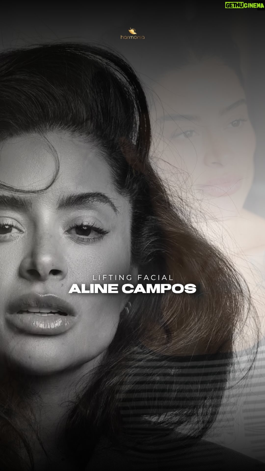 Aline Campos - 93.7K Likes - Essa não é uma história sobre estética.
Essa é uma história sobre verdade, sobre reconstrução, sobre reencontro.

Para uma mulher que sempre foi estereotipada pela própria beleza e pelas suas convicções, provar que tudo é além da beleza, se torna um desafio até mais forte.

Aline não nos procurou para mudar quem ela era, mas, sim, para alinhar o rosto com a pessoa que ela se torna a cada dia.

Quer continuar acompanhando a história da @soualinecampos ? Aguarde.

✅Publicação de caráter acadêmico em conformidade com o despacho 143/2019 Conselho Federal de Medicina, art. 75, e autorizado via Termo de Consentimento Informado.
✅O resultado imediato pode sofrer alterações da cicatrização, inchaço, reabsorção das estruturas e pode não ser o mesmo após vários meses ou anos. Pode ter melhor definição ou perdê-la com o tempo dependendo das características de cada paciente.
✅Além disso, esse video NÃO serve como um modelo a ser escolhido para a sua cirurgia, pois o resultado sempre será de caráter individual e pessoal. Não garantimos resultados.

#liftingfacial #facelift #deepplanefacelift #deepplane #alinecampos 

CRMRS11664 RT Dra Mariana Losso CRMRS35448 Dermatologista RQE33622