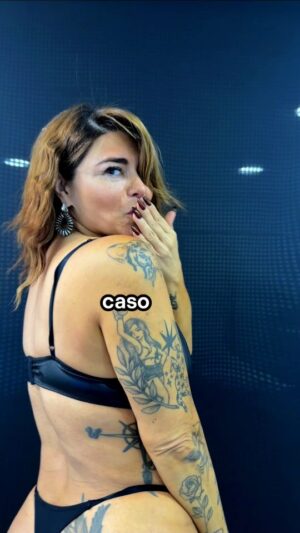 Antonella Ríos Instagram - 🎥 Acompáñanos a ver la evolución de este tratamiento de glúteos

🔸️Así comenzaba el caso de Antonella Ríos: poco volumen y piel que necesitaba más firmeza ✨

👩‍⚕️ Trabajamos con una terapia combinada para estimular, rellenar y mejorar la calidad de la piel:

✔️ Sculptra
✔️ Powerfill
✔️ Mesoheal

💉 Desde la primera sesión ya se notan cambios… pero seguimos potenciando.

En esta etapa reforzamos:
🍑 Zona de hip dips (laterales)
🍑 Cuadrante inferior del glúteo

✨️Resultado: Glúteos más voluminosos, con una piel más elástica y firme.

📩 ¿Te gustaría lograr un cambio similar? Envíanos un mensaje y te contamos todo.