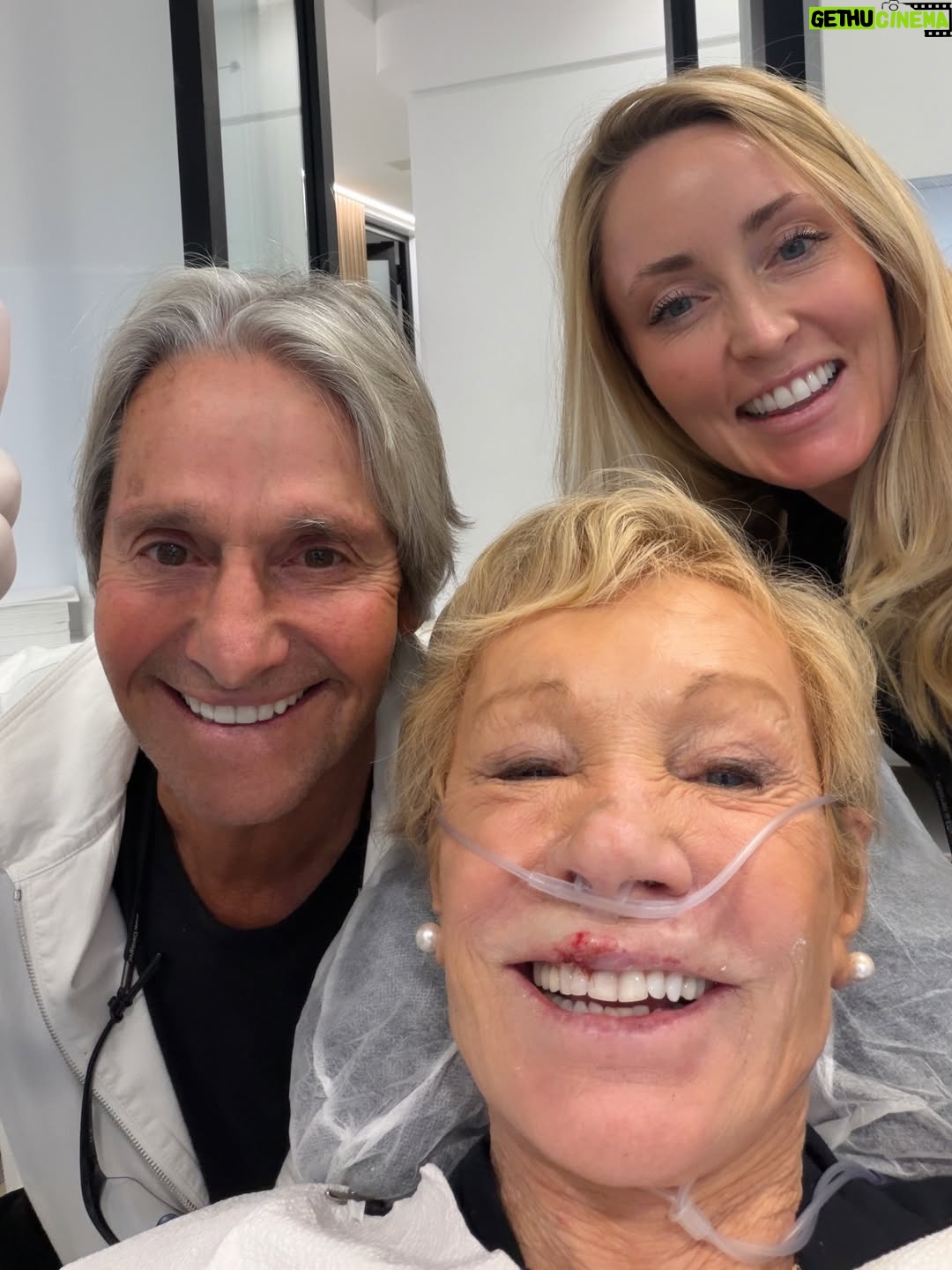Barbara Corcoran - 38.7K Likes - Saved by my lone crooked tooth!

I stopped by my new apartment to check on the renovations. Curiosity didn’t kill the cat, but it sure did take me down.

I tripped, and as I fell, my only thought was, “please, just not my face!” Well, I landed face-first. Somehow, my one crooked tooth broke the fall. 

My upper lip was barely hanging on and there was a lot of blood. (I’ll spare you the photos, but trust me.)

And then, like something out of a movie, the building super appeared and casually mentioned there was an incredible doctor in the building who could stitch me up on the spot.

5 stitches on my lip later from @drjohnesherman, and I was good to go! I had planned to travel early tomorrow for four speeches in four cities and I looked damn scary with my front tooth missing. 

“Take MY dentist appointment,” Dr. Sherman said. “I have a toothache and I’m due there in five minutes. He’s the best cosmetic dentist in the city. It takes months to get in.”

Next thing I knew, we were in the Dr. Sherman’s Porsche parked out front, driving a few blocks south. Talk about 5 stars! 

30 minutes later I walked out with my brand-new front tooth, straight as an arrow. 

A major upgrade from my brave tooth that’s probably still buried at the scene. Long story short, I knocked out my front tooth and didn’t even get a gold medal for it.