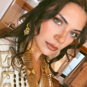 Biran Damla Yılmaz Instagram - ✨🐥