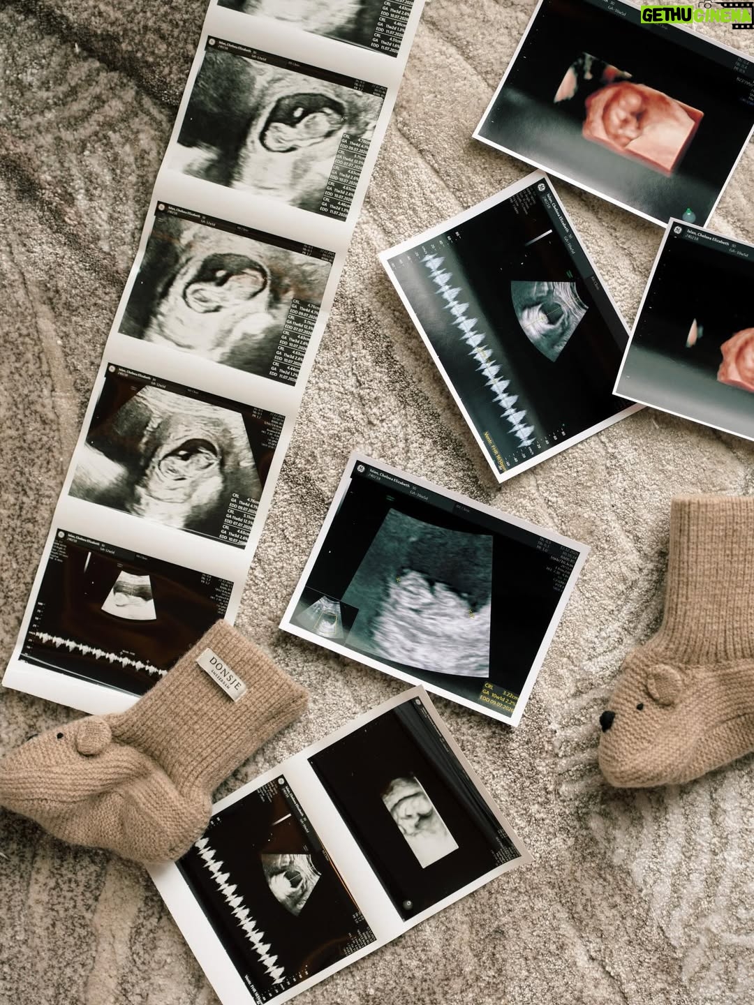 Chelsea Islan - 393.3K Likes - Happy 33rd Birthday to my Husband! Soon to be Dad. This year is incredibly special for us, as we are celebrating together as three, with our little one on the way. Carrying a Blessing 🤍