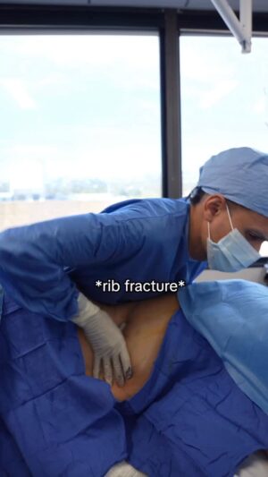 Gia Gunn Instagram - Is your sound on?🎧🩻 @drocplasticsurgery surgically fractured 10 of my ribs and I couldn’t be happier🥰 #bethatbeautiful #ribsculpt @ribsculpt https://www.bethatbeautiful.com/giagunn book a consult today- your welcome!