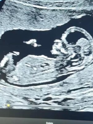 Kelsey Owens Instagram - Bits and pieces of my first trimester ♥️

The months where everything changed.
The naps, the nerves, the whispered prayers.
The countless times we looked at each other and said “Is this actually happening?”

Three months down, six to go.
Baby Strong you’re already SO loved. We can’t wait to meet you!