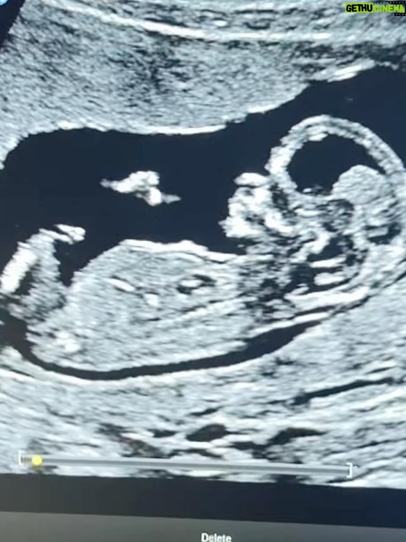 Kelsey Owens - 76.7K Likes - Bits and pieces of my first trimester ♥️

The months where everything changed.
The naps, the nerves, the whispered prayers.
The countless times we looked at each other and said “Is this actually happening?”

Three months down, six to go.
Baby Strong you’re already SO loved. We can’t wait to meet you!