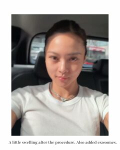 Actress Kim Chiu HD Photos and Wallpapers March 2026
