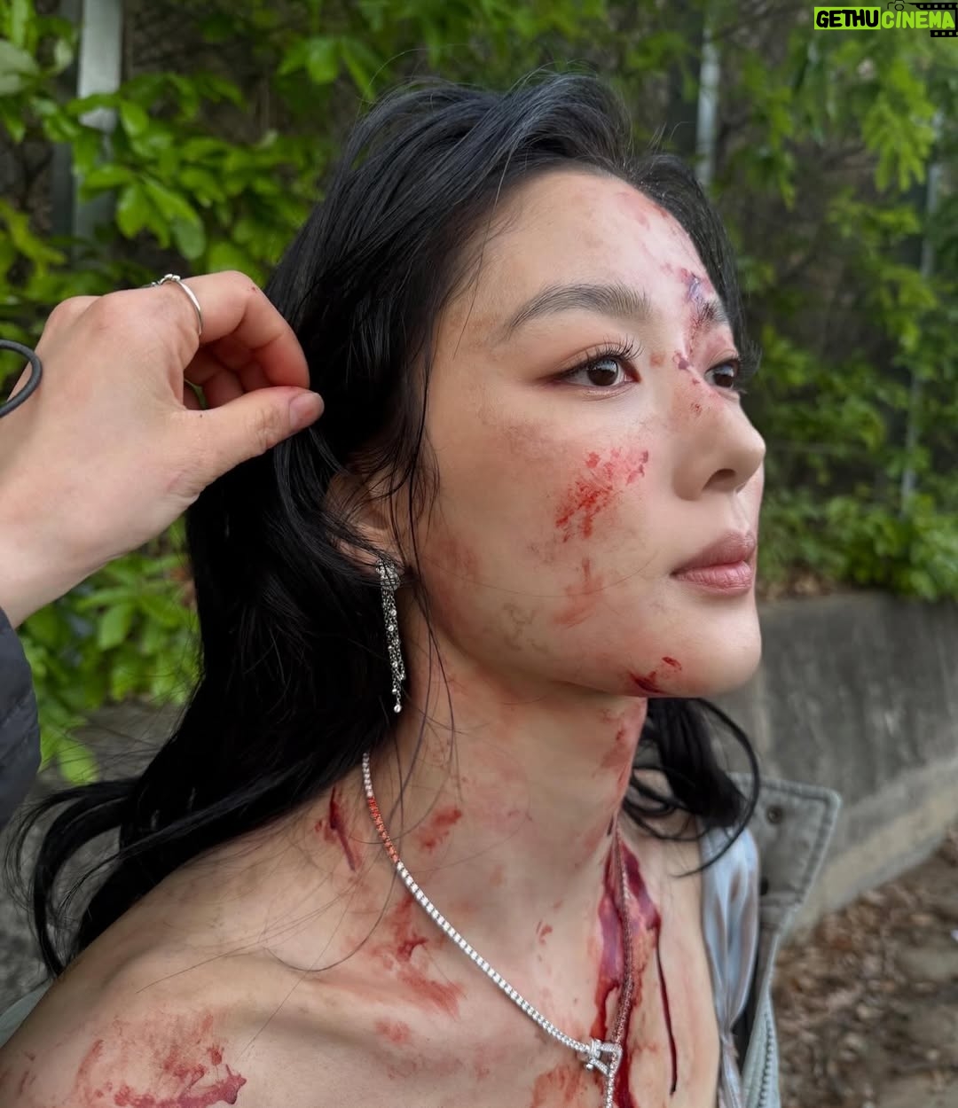 Kim You-jung - 3.2 Million Likes - 