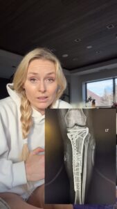 Actress Lindsey Vonn HD Photos and Wallpapers March 2026