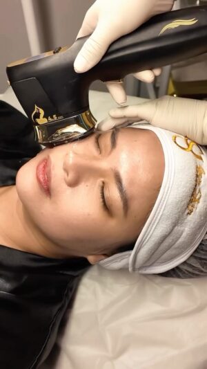Louise delos Reyes Instagram - Starting to notice less definition on your jawline? This might help. ✨
Our 22D Max HIFU treatment uses advanced ultrasound technology to help support skin tightening, lifting, and facial contouring—all without surgery.
Benefits:
• Helps improve skin firmness
• Supports a more defined jawline
• Stimulates collagen production
• Non-invasive with minimal downtime
• Gradual, natural-looking results
Experience the power of 22D Max HIFU at Genskin Aesthetic.
Send us a message to learn more or book your appointment 📩
Results may vary per individual.
☎️ 09156717163
📩 genskin.aesthetic@gmail.com
📍Elements Hall #27 Scout Rallos Timog Ave. Quezon City
#GenskinAesthetic #22DMaxHIFU #HIFUTreatment #NonSurgicalLift #SkinTightening #JawlineContour #CollagenBoost
