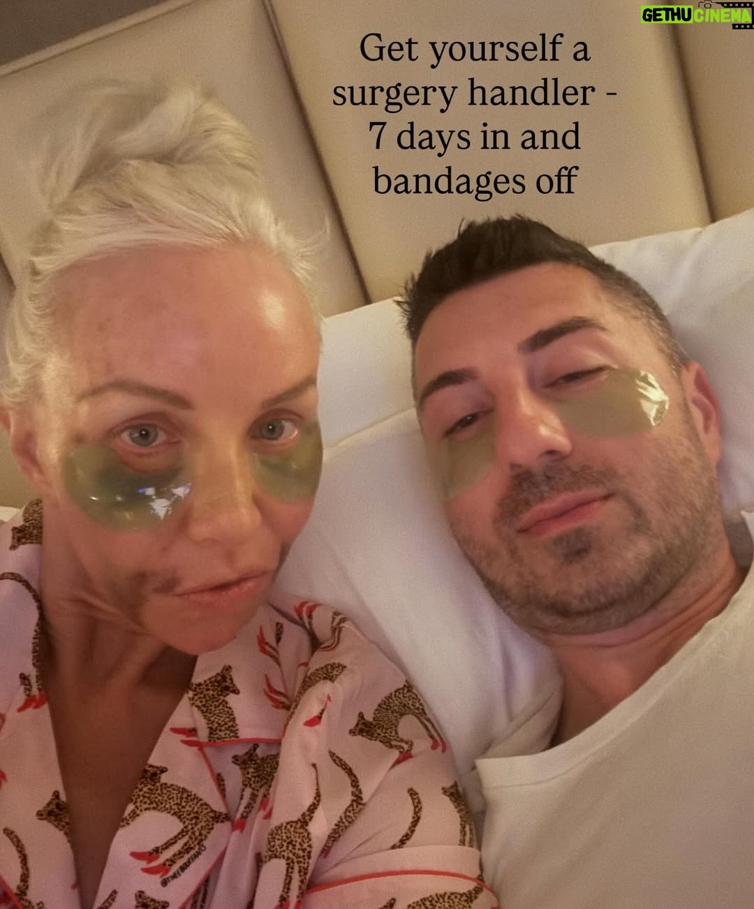Margaret Josephs - 10K Likes - No one wants a droopy tip… some might call it a rhinoplasty I call it a “nasal rejuvenation”’😜 as I got older my tip started to droop as I smiled and I was really unhappy about it. When I was younger I never disliked my nose and could never imagine doing a nose job but with age the cartilage in my nose didn’t support my tip and it emphasized a slight bump in my nose also. Every photo of me I really noticed it and it bothered me. I went to @drgarymotykie for a slight tweak and now my nose fits my face so perfectly and no one can quite put their finger on why… not even my family members! I am a huge advocate for doing what makes YOU happy and feel your best. Thank you Dr Motykie for this subtle upgrade, it made such a huge difference to me 🙌🏼 Read the full article in @newbeauty and see photos of me scaring small children around the @bevhillshotel pool - best place to recover EVER
Thank you @tatianabido for this fab piece! 
Ps I also has fat transfer and stem cells on my face so as you swipe you’ll see the swelling, don’t freak out it 😂 it was to restore volume in the face too