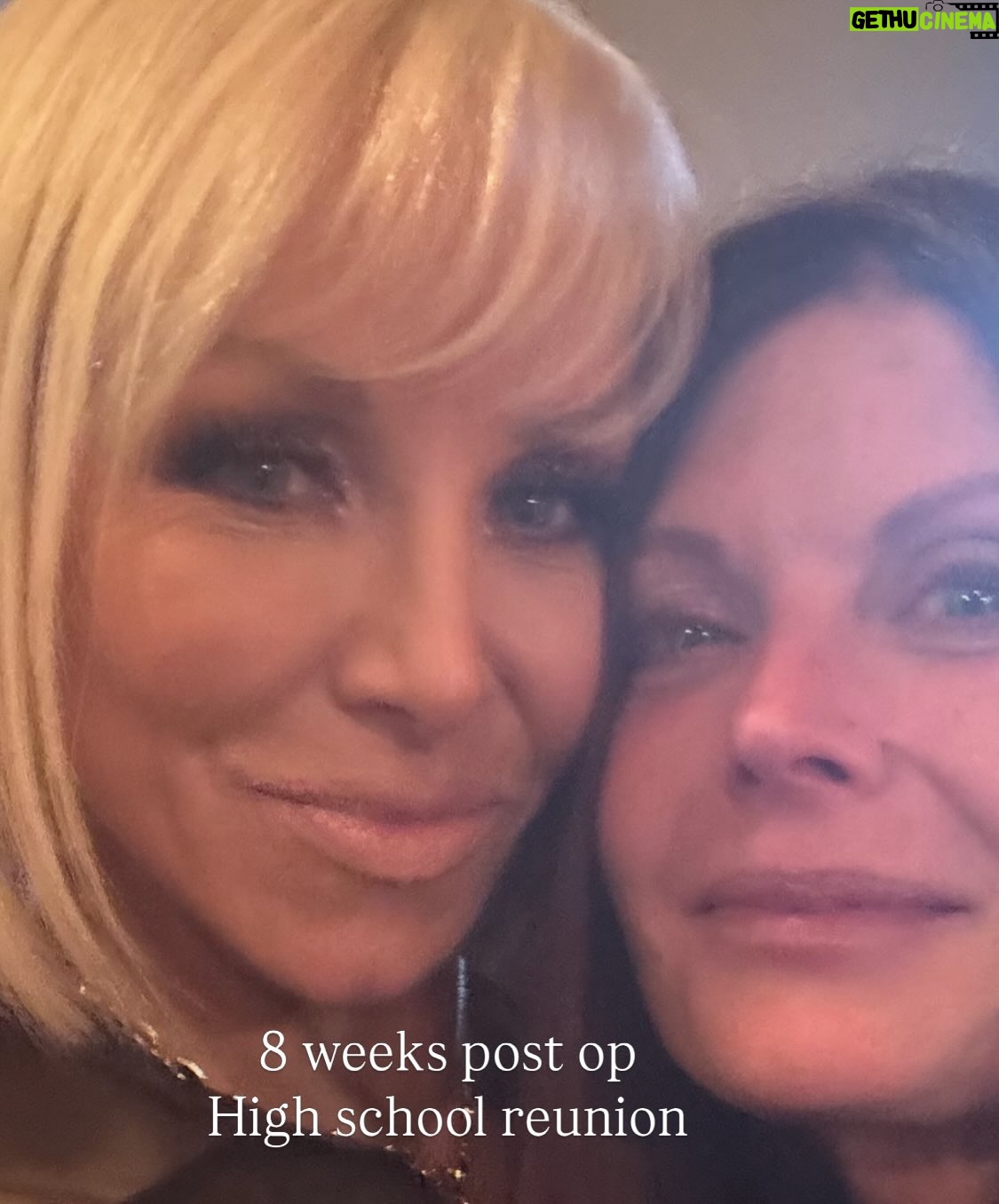 Margaret Josephs - 10K Likes - No one wants a droopy tip… some might call it a rhinoplasty I call it a “nasal rejuvenation”’😜 as I got older my tip started to droop as I smiled and I was really unhappy about it. When I was younger I never disliked my nose and could never imagine doing a nose job but with age the cartilage in my nose didn’t support my tip and it emphasized a slight bump in my nose also. Every photo of me I really noticed it and it bothered me. I went to @drgarymotykie for a slight tweak and now my nose fits my face so perfectly and no one can quite put their finger on why… not even my family members! I am a huge advocate for doing what makes YOU happy and feel your best. Thank you Dr Motykie for this subtle upgrade, it made such a huge difference to me 🙌🏼 Read the full article in @newbeauty and see photos of me scaring small children around the @bevhillshotel pool - best place to recover EVER
Thank you @tatianabido for this fab piece! 
Ps I also has fat transfer and stem cells on my face so as you swipe you’ll see the swelling, don’t freak out it 😂 it was to restore volume in the face too