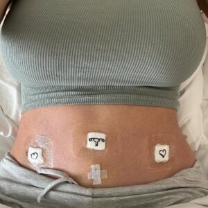 Maryse Mizanin Instagram - Two years ago today, on March 8, I woke up from a full radical hysterectomy that removed every tumor from my body. It was a moment that changed my life, but it didn’t create the strength inside me, that fire was already there, built through storms I had faced long before that day.

This chapter was simply another crossing in a much longer journey.

Today, on International Women’s Day, I think about the way we all carry different boats within us as we move across life’s waters. One holds the weight of everything we’ve survived, the hard lessons, the grief, the battles fought in silence. The other carries our resilience, our voice, and the power we’ve been building all along. My surgery didn’t build those boats, it revealed just how strong they already were.

Two years later, I’m still rowing forward with the same fire that has carried me through every chapter of my life, the same fire that pushed me to write the book I have coming soon.

To every woman navigating her own waters: your strength didn’t start with your hardest moment. It was already in you long before the world saw it. 💜