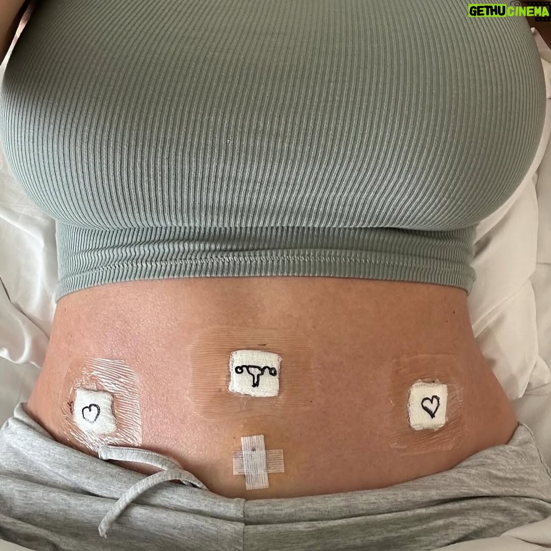 Maryse Mizanin - 55.7K Likes - Two years ago today, on March 8, I woke up from a full radical hysterectomy that removed every tumor from my body. It was a moment that changed my life, but it didn’t create the strength inside me, that fire was already there, built through storms I had faced long before that day.

This chapter was simply another crossing in a much longer journey.

Today, on International Women’s Day, I think about the way we all carry different boats within us as we move across life’s waters. One holds the weight of everything we’ve survived, the hard lessons, the grief, the battles fought in silence. The other carries our resilience, our voice, and the power we’ve been building all along. My surgery didn’t build those boats, it revealed just how strong they already were.

Two years later, I’m still rowing forward with the same fire that has carried me through every chapter of my life, the same fire that pushed me to write the book I have coming soon.

To every woman navigating her own waters: your strength didn’t start with your hardest moment. It was already in you long before the world saw it. 💜