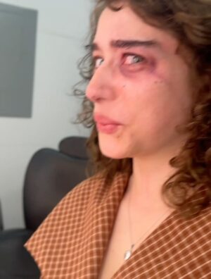 Odessa A'zion Instagram - well.. it beat the shit out of me and the beautiful thing is I’d still do it all over again. over and over and over and over and over and over. have y’all seen it yet or what 🥹