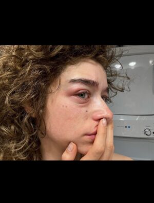 Odessa A'zion Instagram - well.. it beat the shit out of me and the beautiful thing is I’d still do it all over again. over and over and over and over and over and over. have y’all seen it yet or what 🥹