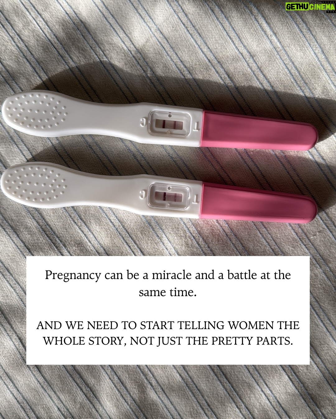 Shubhi Garg Agarwal - 318 Likes - // They call pregnancy the most beautiful phase of a woman’s life and glorify the glow and the bump, but no one really talks about the pain, the fear, and the exhaustion that come with it! 😭

PS: This isn’t a complaint. 
It’s a reminder that behind every “strong mom” is a pregnancy that tested her in ways no one saw!

If you’ve felt this too, you’re not alone! 🤰🏼💉
Let’s talk about the pregnancy truths no one posts about.
.
.
.
.
.
.
.
.
.
.
#PregnancyJourney #ThirdTrimester #RealMotherhood #ExpectingMomIndia #PregnancyTruths [pregnancy pain, third trimester struggles, breech baby stress, pregnancy truth, hospital bag prep, labour anxiety, c section fear, vaginal delivery india, pregnancy injections, prenatal scans, emotional pregnancy, motherhood journey, honest motherhood, Indian pregnancy journey, pregnancy mood swings, preparing for birth, things no one tells you about pregnancy]