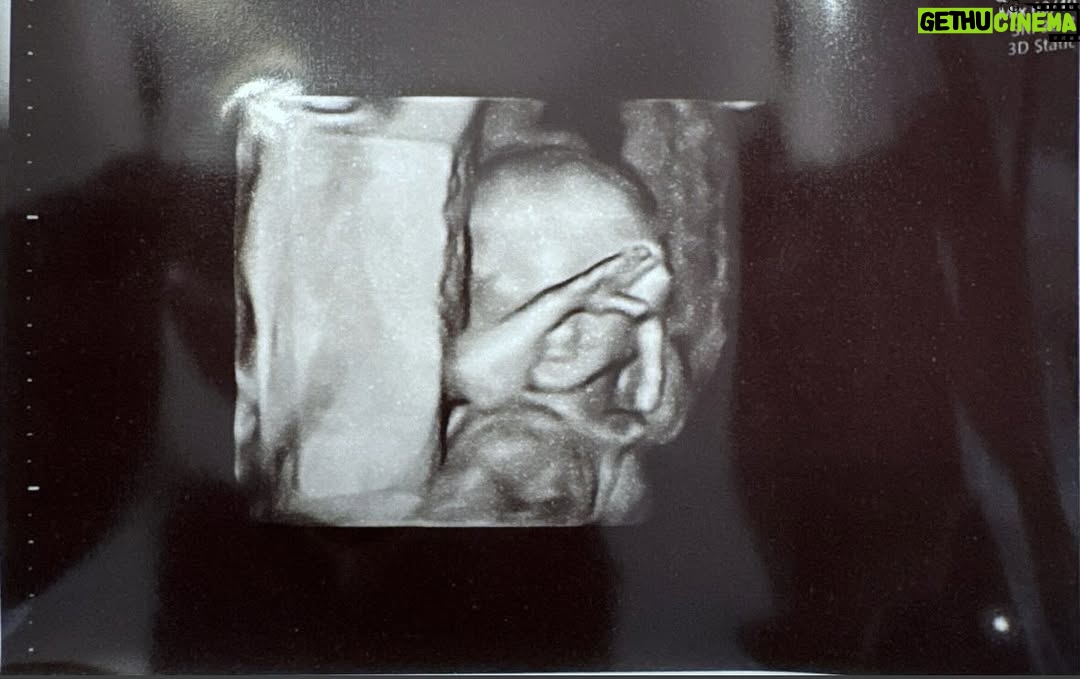 Trinity Fatu - 102.3K Likes - Dabbing at #16weeks is crazy 😂 #babyfatu @jonathanfatu